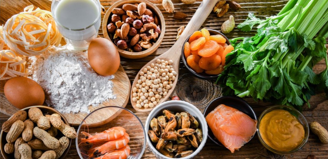 Image of key food allergies including milk, egs, flour, nuts, shellfish Image of key food allergies including milk, egs, flour, nuts, shellfish